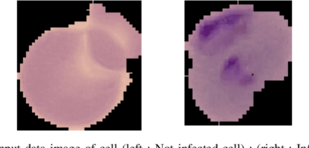 Figure 1 for Malaria detection using Deep Convolution Neural Network