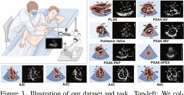 Figure 4 for EchoWorld: Learning Motion-Aware World Models for Echocardiography Probe Guidance