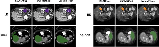 Figure 3 for Improving 3D Few-Shot Segmentation with Inference-Time Pseudo-Labeling