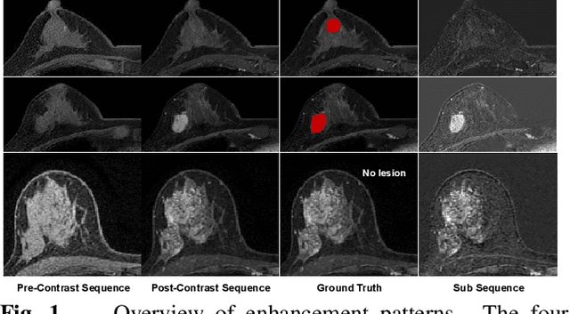 Figure 1 for Clinical Inspired MRI Lesion Segmentation