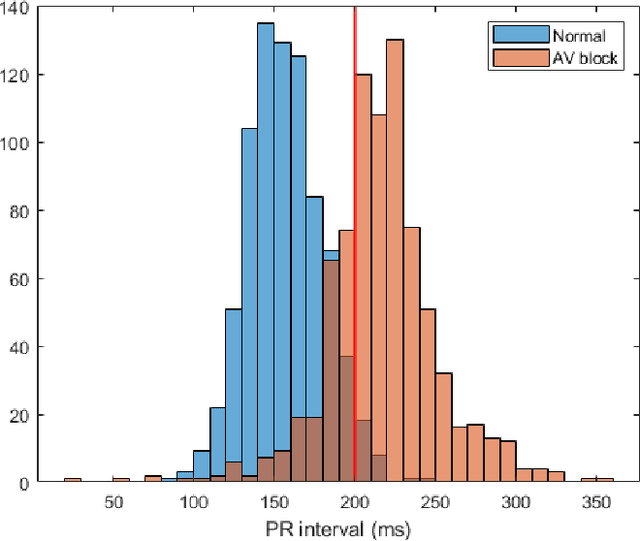 Figure 1 for ECG Feature Importance Rankings: Cardiologists vs. Algorithms