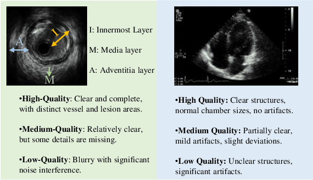 Figure 2 for Ultrasound-QBench: Can LLMs Aid in Quality Assessment of Ultrasound Imaging?