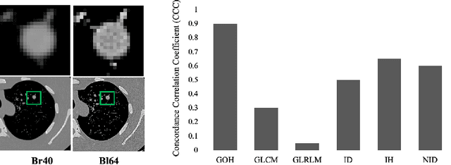 Figure 1 for DiffusionCT: Latent Diffusion Model for CT Image Standardization