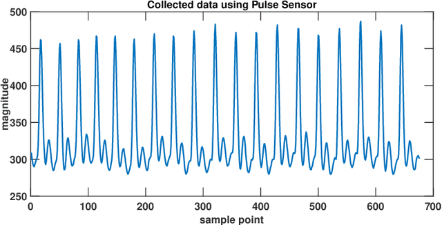 Figure 3 for Machine Learning-Based Automatic Cardiovascular Disease Diagnosis Using Two ECG Leads