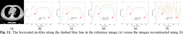 Figure 3 for Deep Radon Prior: A Fully Unsupervised Framework for Sparse-View CT Reconstruction