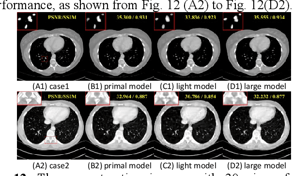 Figure 4 for Deep Radon Prior: A Fully Unsupervised Framework for Sparse-View CT Reconstruction