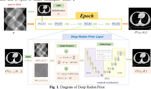 Figure 1 for Deep Radon Prior: A Fully Unsupervised Framework for Sparse-View CT Reconstruction