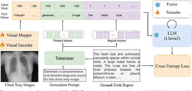 Figure 1 for R2GenGPT: Radiology Report Generation with Frozen LLMs