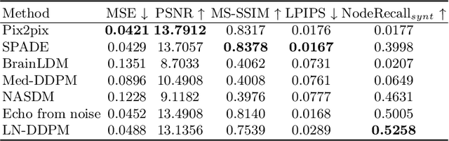 Figure 2 for CT Synthesis with Conditional Diffusion Models for Abdominal Lymph Node Segmentation