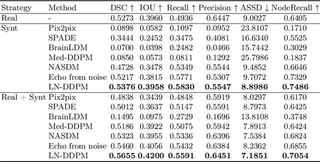 Figure 4 for CT Synthesis with Conditional Diffusion Models for Abdominal Lymph Node Segmentation