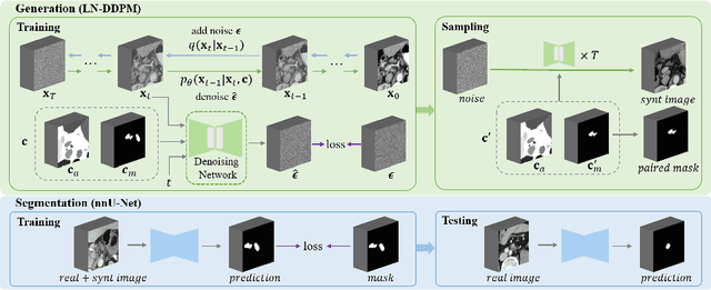 Figure 1 for CT Synthesis with Conditional Diffusion Models for Abdominal Lymph Node Segmentation