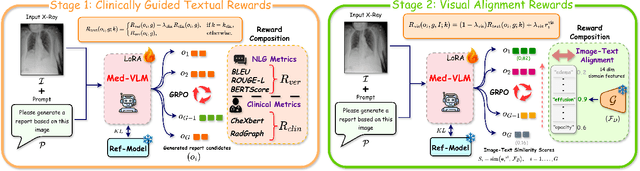 Figure 4 for Visual Alignment of Medical Vision-Language Models for Grounded Radiology Report Generation