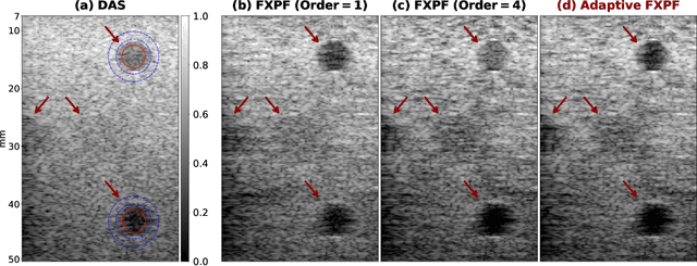 Figure 1 for Frequency-Space Prediction Filtering for Phase Aberration Correction in Plane-Wave Ultrasound