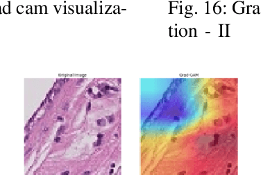 Figure 3 for Enhancing GANs with Contrastive Learning-Based Multistage Progressive Finetuning SNN and RL-Based External Optimization