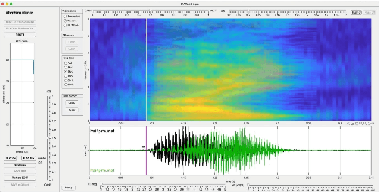 Figure 4 for Interactive tools for making temporally variable, multiple-attributes, and multiple-instances morphing accessible: Flexible manipulation of divergent speech instances for explorational research and education