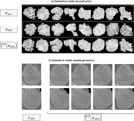 Figure 3 for Learning Transferable Object-Centric Diffeomorphic Transformations for Data Augmentation in Medical Image Segmentation