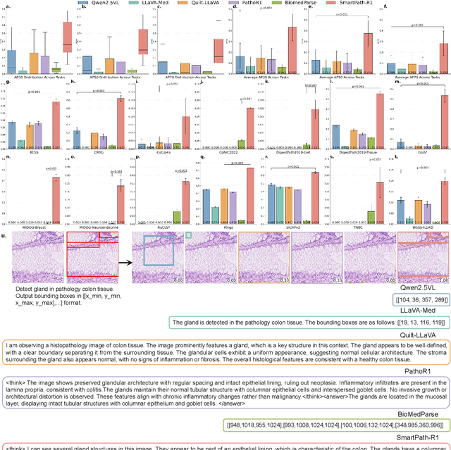 Figure 4 for A Versatile Pathology Co-pilot via Reasoning Enhanced Multimodal Large Language Model