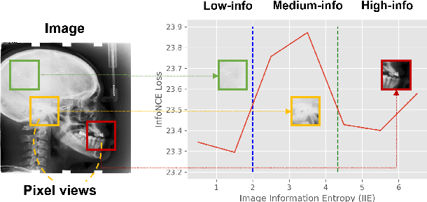 Figure 3 for Information-guided pixel augmentation for pixel-wise contrastive learning