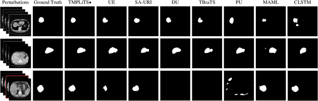 Figure 4 for Trustworthy Multi-phase Liver Tumor Segmentation via Evidence-based Uncertainty