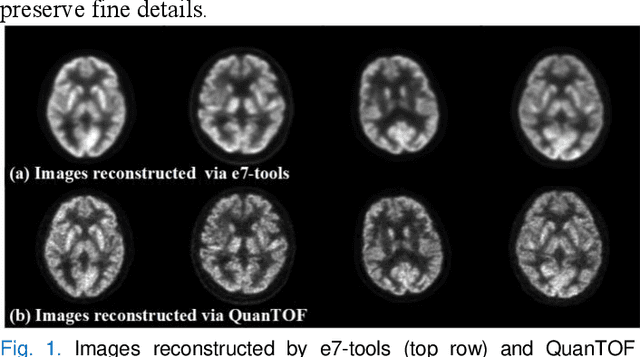 Figure 1 for Cycle-Constrained Adversarial Denoising Convolutional Network for PET Image Denoising: Multi-Dimensional Validation on Large Datasets with Reader Study and Real Low-Dose Data