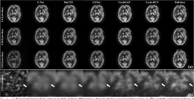 Figure 4 for Cycle-Constrained Adversarial Denoising Convolutional Network for PET Image Denoising: Multi-Dimensional Validation on Large Datasets with Reader Study and Real Low-Dose Data