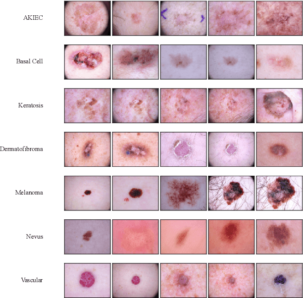 Figure 3 for Uncertainty-Aware Deep Learning for Automated Skin Cancer Classification: A Comprehensive Evaluation