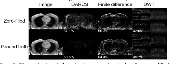 Figure 2 for DARCS: Memory-Efficient Deep Compressed Sensing Reconstruction for Acceleration of 3D Whole-Heart Coronary MR Angiography
