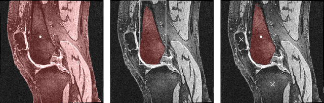 Figure 3 for Novel adaptation of video segmentation to 3D MRI: efficient zero-shot knee segmentation with SAM2