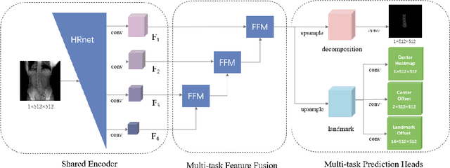 Figure 4 for Three-dimensional Reconstruction of the Lumbar Spine with Submillimeter Accuracy Using Biplanar X-ray Images