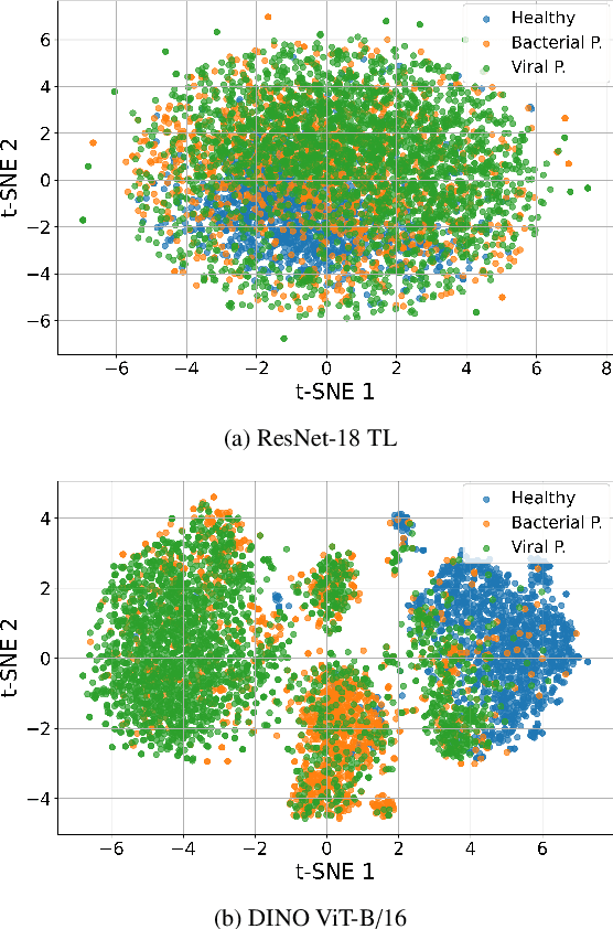 Figure 3 for SVD Based Least Squares for X-Ray Pneumonia Classification Using Deep Features