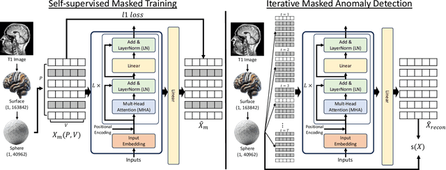 Figure 1 for Learning Cortical Anomaly through Masked Encoding for Unsupervised Heterogeneity Mapping