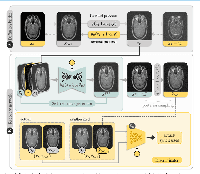 Figure 3 for Self-Consistent Recursive Diffusion Bridge for Medical Image Translation