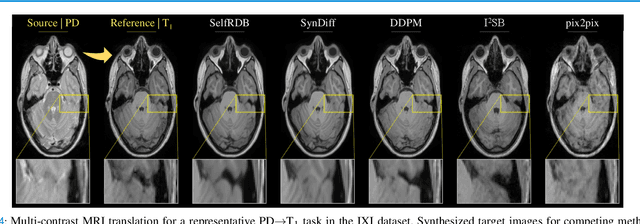 Figure 4 for Self-Consistent Recursive Diffusion Bridge for Medical Image Translation