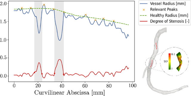 Figure 2 for Pericoronary adipose tissue attenuation as a predictor of functional severity of coronary stenosis