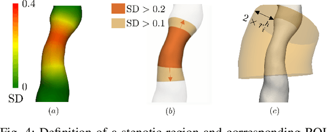 Figure 4 for Pericoronary adipose tissue attenuation as a predictor of functional severity of coronary stenosis