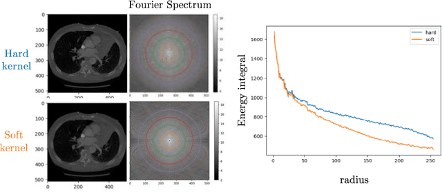 Figure 3 for Self-supervised learning of imaging and clinical signatures using a multimodal joint-embedding predictive architecture