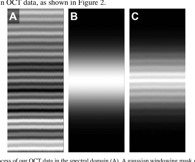 Figure 3 for Spectral Bandwidth Recovery of Optical Coherence Tomography Images using Deep Learning