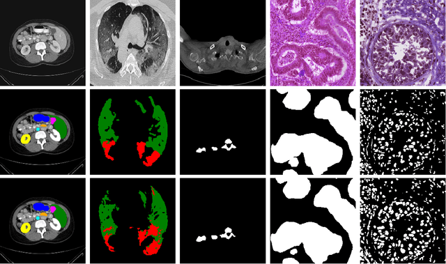Figure 1 for Rethinking Attention Gated with Hybrid Dual Pyramid Transformer-CNN for Generalized Segmentation in Medical Imaging