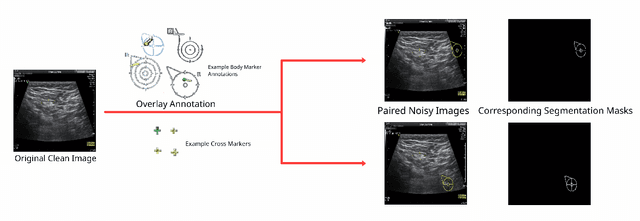Figure 2 for Ultrasonic Image's Annotation Removal: A Self-supervised Noise2Noise Approach