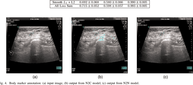 Figure 4 for Ultrasonic Image's Annotation Removal: A Self-supervised Noise2Noise Approach