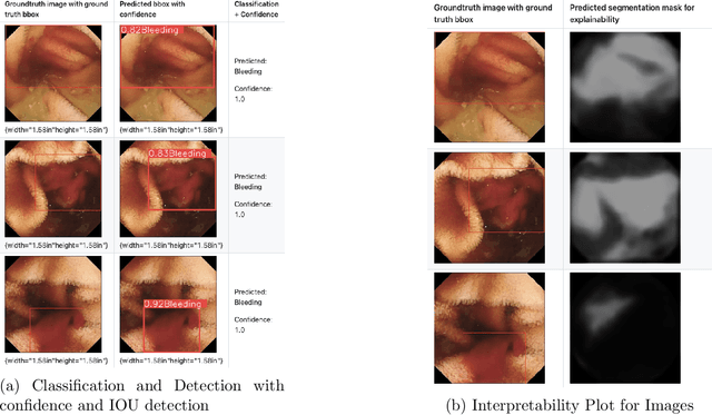 Figure 4 for ClassifyViStA:WCE Classification with Visual understanding through Segmentation and Attention