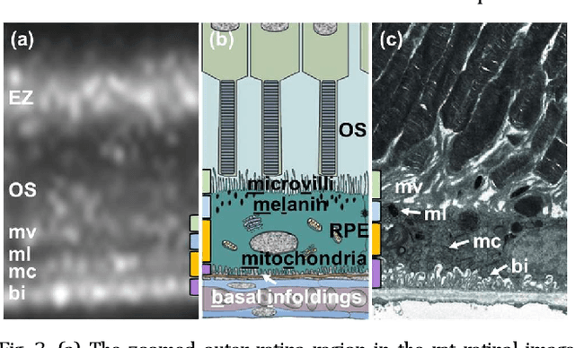 Figure 4 for Sub2Full: split spectrum to boost OCT despeckling without clean data