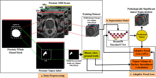 Figure 1 for Enhancing Semantic Segmentation with Adaptive Focal Loss: A Novel Approach