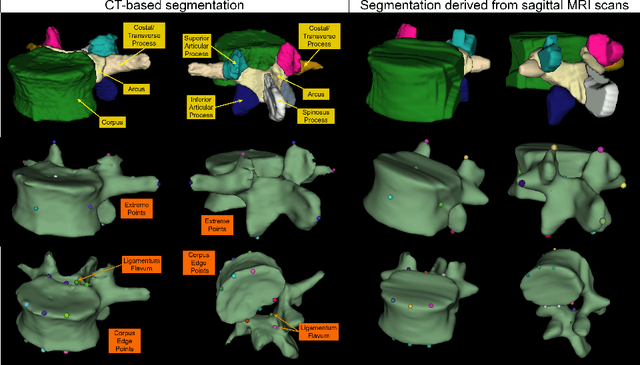 Figure 1 for Rule-based Key-Point Extraction for MR-Guided Biomechanical Digital Twins of the Spine