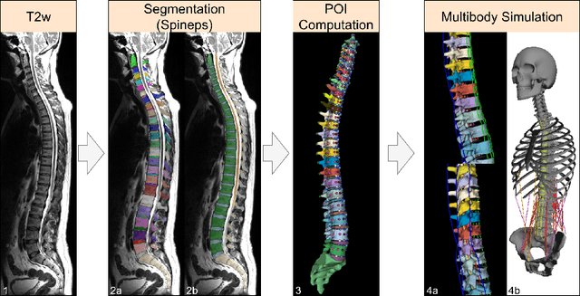Figure 3 for Rule-based Key-Point Extraction for MR-Guided Biomechanical Digital Twins of the Spine