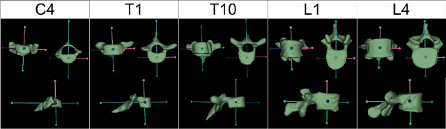 Figure 4 for Rule-based Key-Point Extraction for MR-Guided Biomechanical Digital Twins of the Spine