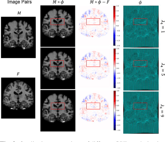 Figure 4 for Conditional Deformable Image Registration with Spatially-Variant and Adaptive Regularization