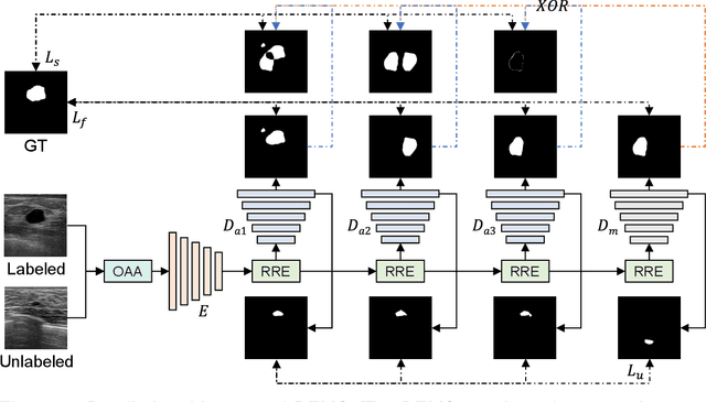 Figure 1 for Segmenting Medical Images with Limited Data