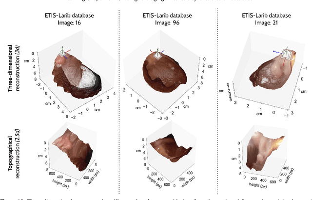 Figure 3 for Leveraging a realistic synthetic database to learn Shape-from-Shading for estimating the colon depth in colonoscopy images