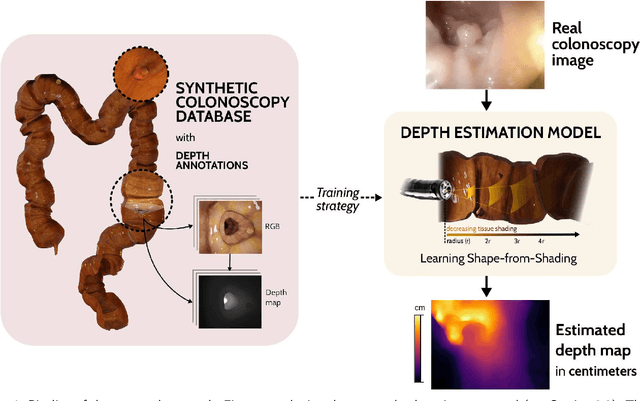 Figure 1 for Leveraging a realistic synthetic database to learn Shape-from-Shading for estimating the colon depth in colonoscopy images